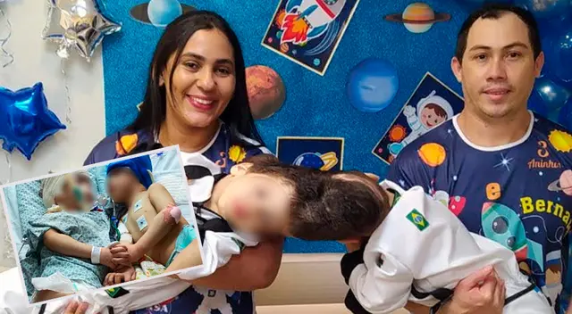 Como gemelos craneópagos, Arthur y Bernardo de 3 años, compartían cráneos fusionados, cerebros entrelazados y vasos sanguíneos Como gemelos craneópagos, Arthur y Bernardo de 3 años, compartían cráneos fusionados, cerebros entrelazados y vasos sanguíneos