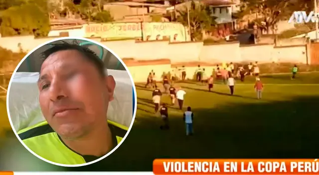 Producto de la salvaje agresión ha perdido de manera temporal la visión del ojo izquierdo.