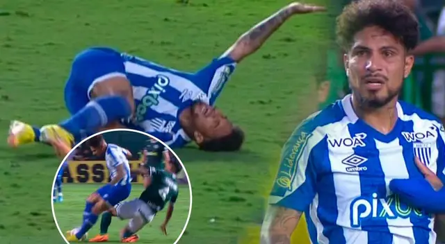 Paolo Guerrero abandonó la cancha tras brutal patada del rival.