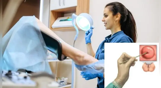 Los chequeos preventivos son la mejor prevención contra cualquier tipo de cáncer.