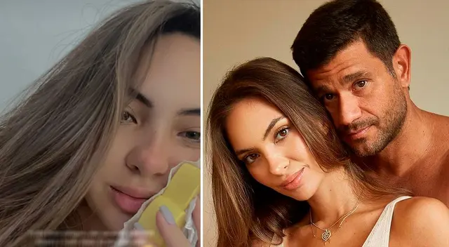 Natalie Vertiz y Yaco Eskenazi tuvieron una operación dental.