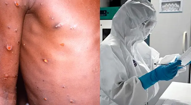 Paciente se encuentra aislado y bajo los cuidados de expertos en temas de salud.