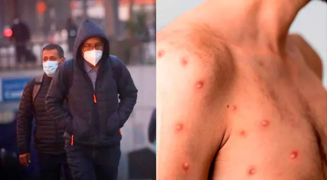 La región con más casos de viruela del mono es Lima Metropolitana. La región con más casos de viruela del mono es Lima Metropolitana.