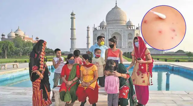 Conoce cuáles son los síntomas de la gripe del tomate que ataca principalmente a niños.