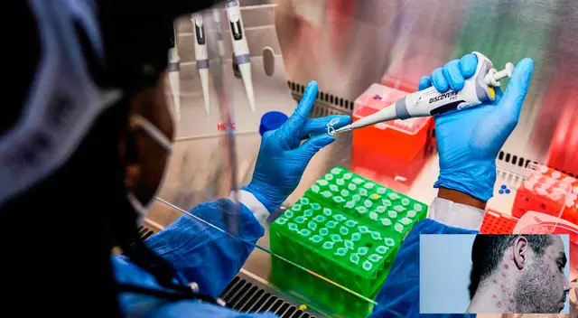 El INS identificó un nuevo linaje peruano del virus causante de la viruela del mono, denominado B.1.6 por el Comité Científico Internacional. El INS identificó un nuevo linaje peruano del virus causante de la viruela del mono, denominado B.1.6 por el Comité Científico Internacional.