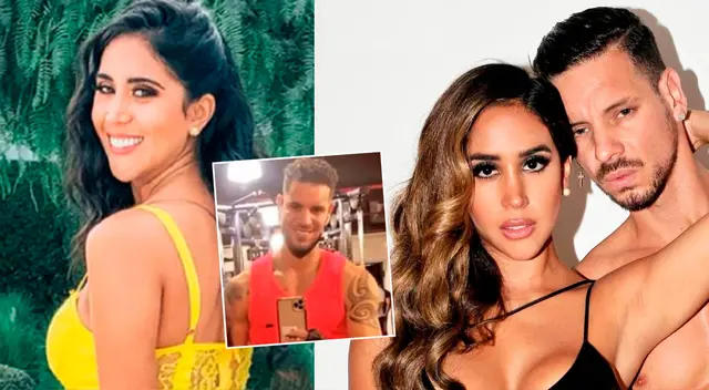 Melissa Paredes defiende a su pareja Anthony Aranda tras supuesto 'retoquito'.