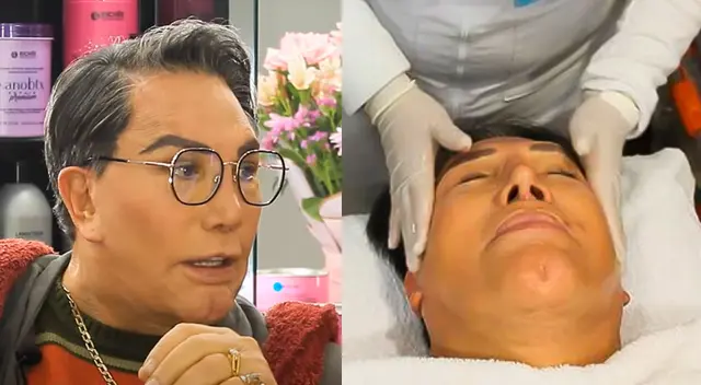 Jimmy Santi jura que solo tiene cuatro cirugías plásticas en la cara Jimmy Santi jura que solo tiene cuatro cirugías plásticas en la cara