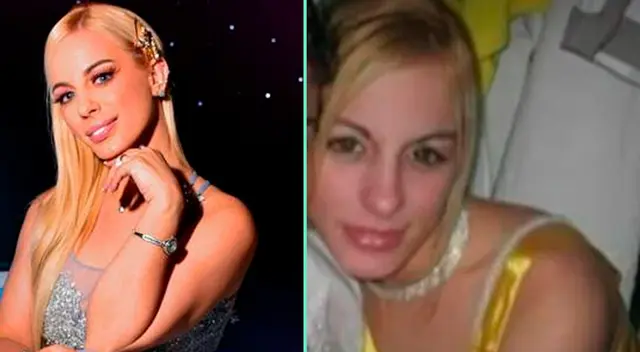 Dalia Durán su antes y después en esta nota de El Popular.