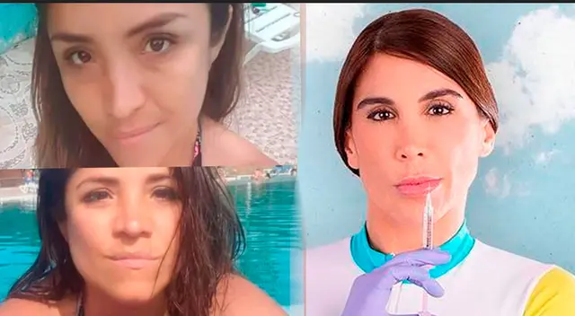 Katty Villalobos defiende a Dra Fit y asegura que le hizo una buena praxis: 'Esta es mi verdad'.