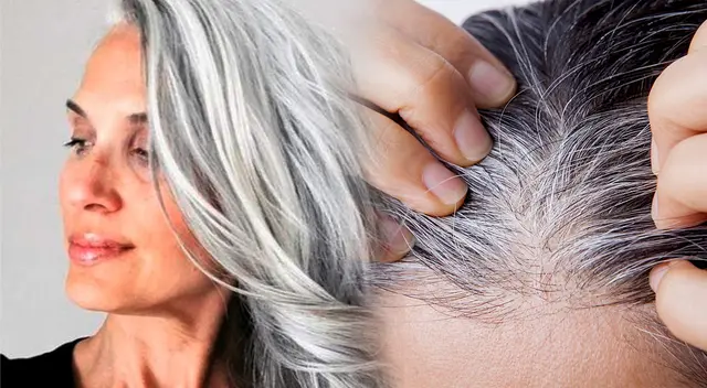 Conoce cómo prevenir las canas Conoce cómo prevenir las canas