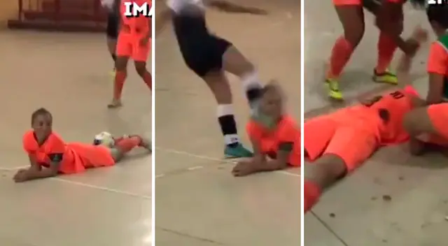 La futbolista quedó lesionada en el rostro. La futbolista quedó lesionada en el rostro.