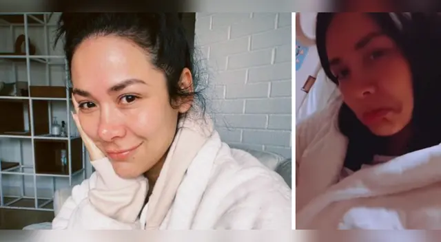 Magdyel Ugaz fue sometida a operación.