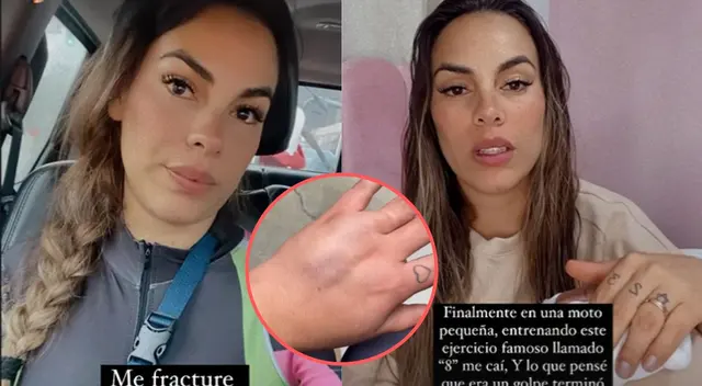 Aída Martínez sufre por caída de moto