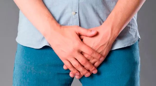 Imagen referencial sobre la vasectomía