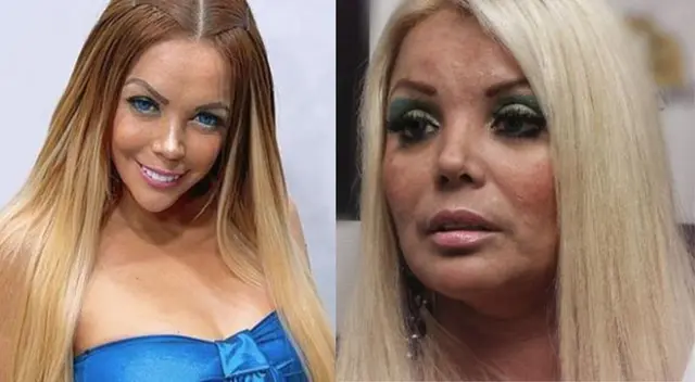 Shirley Cherres preocupa a seguidores Shirley Cherres preocupa a seguidores