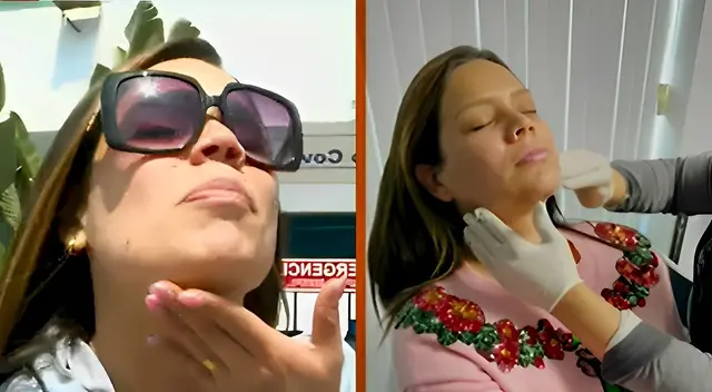 Andrea San Martín habló a detalle de su procedimiento.