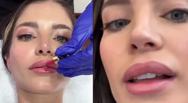 Flavia Laos se somete a tratamiento estético.