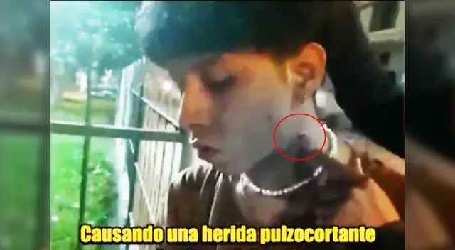 Joven agredido por delincuente en el cuelo en San Juan de Lurigancho Joven agredido por delincuente en el cuelo en San Juan de Lurigancho