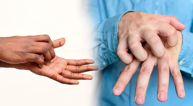 Conoce qué significa que te pique la mano derecha.