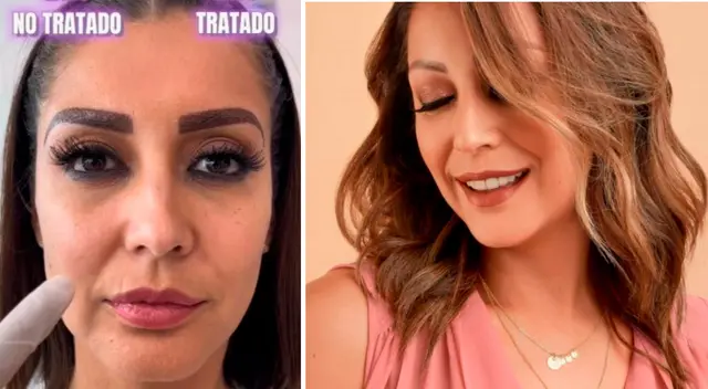 Karla Tarazona sorprende a seguidores con retoque. Karla Tarazona sorprende a seguidores con retoque.