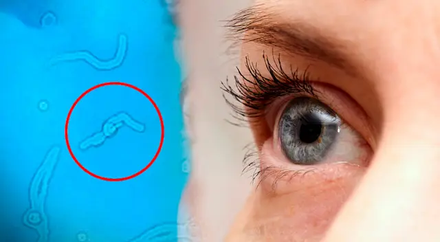 Descubre por qué ves 'gusanitos' cuando mira fijamente.