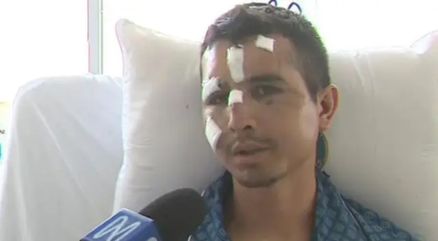 El efectivo policial fue trasladado a Lima junto a otros policías y permanece internado en el hospital de la Policía.