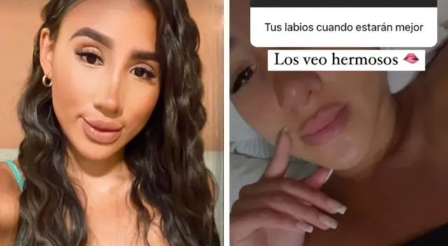 Samahara Lobatón defiende sus retoques y lanza mensaje a detractores.