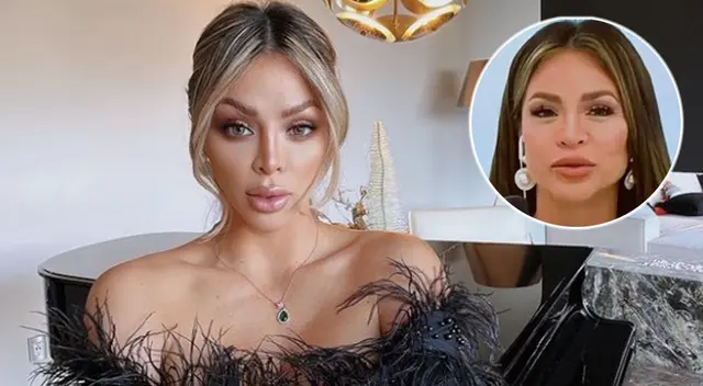 Sheyla Rojas se sometió a una operación estética que ocasionó su parálisis facial.