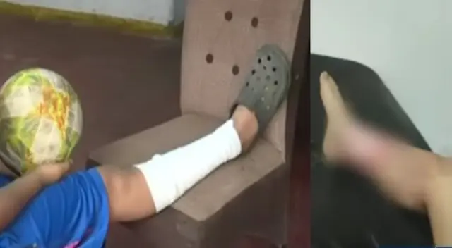 Menor con parte del pie quemado en VMT