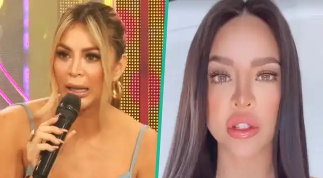 Sheyla Rojas señala no aceptar más canjes tras su parálisis facial. Sheyla Rojas señala no aceptar más canjes tras su parálisis facial.