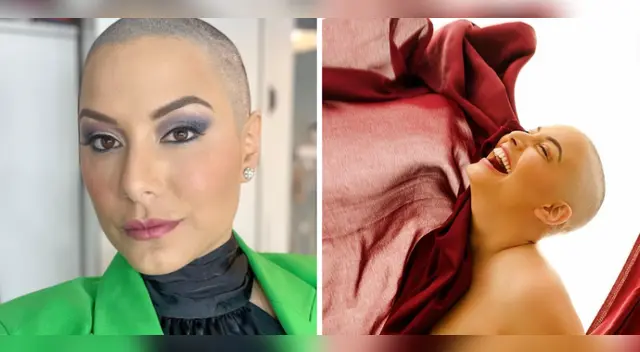 Natalia Salas muestra su mastectomía.