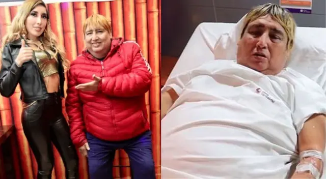 Tongo continúa internado en Cuidados Intensivos Tongo continúa internado en Cuidados Intensivos