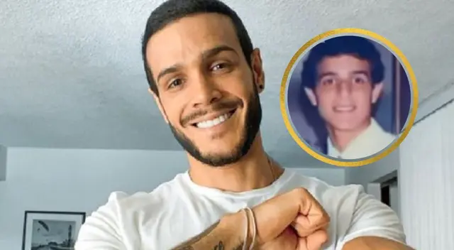 Mario Irivarren se operó de la nariz tres veces. ¿Cuál fue la razón? Mario Irivarren se operó de la nariz tres veces. ¿Cuál fue la razón?