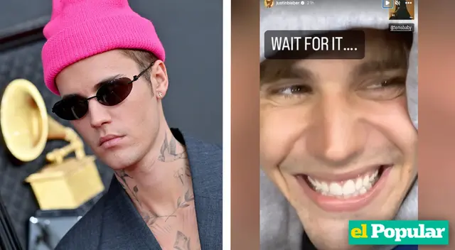 Justin Bieber vuelve a sonreir en Instagram tras complicaciones de rara enfermedad Justin Bieber vuelve a sonreir en Instagram tras complicaciones de rara enfermedad