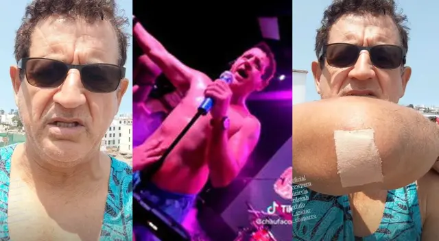 Sergio Galliani Me caí y seguimos cantando, no fue grave.