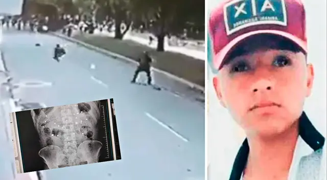 El joven de 22 años falleció tras luchar por su vida cerca de 2 meses en el hospital Loayza. El joven de 22 años falleció tras luchar por su vida cerca de 2 meses en el hospital Loayza.