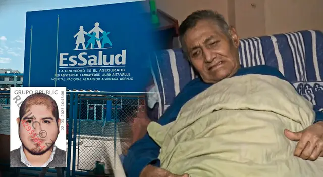 La hija del adulto mayor reveló la identificación del médico que le habría provocado una fractura en su pierna sana.