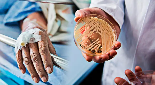 Los casos de Candida auris se expandieron geográficamente.