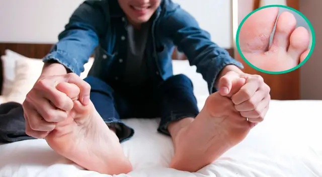 Remedios caseros para eliminar los hongos de los pies Remedios caseros para eliminar los hongos de los pies