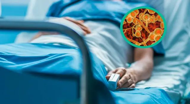 Hongo mortal Candida auris Hongo mortal Candida auris