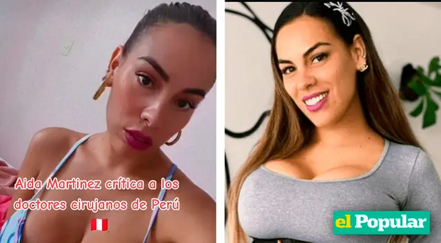 Aida critica fuertemente a cirujanos peruanos Aida critica fuertemente a cirujanos peruanos