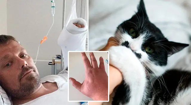 Henrik Kriegbaum Plettner no le prestó importancia a la mordedura.