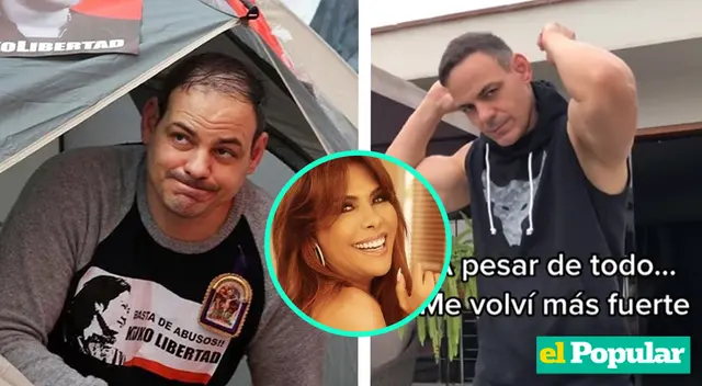 Magaly Medina afirma que Mark Vito se hizo implante capilar