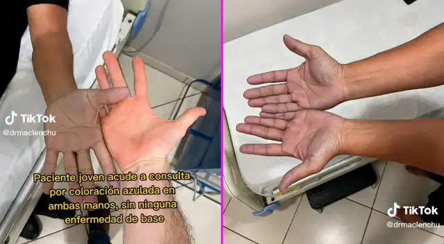 El diagnóstico del joven dejó en shock a miles en TikTok. El diagnóstico del joven dejó en shock a miles en TikTok.