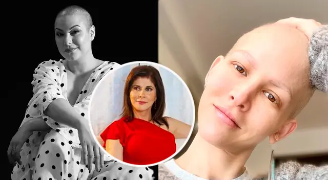 Natalia Salas y otras artistas que vencieron al cáncer.