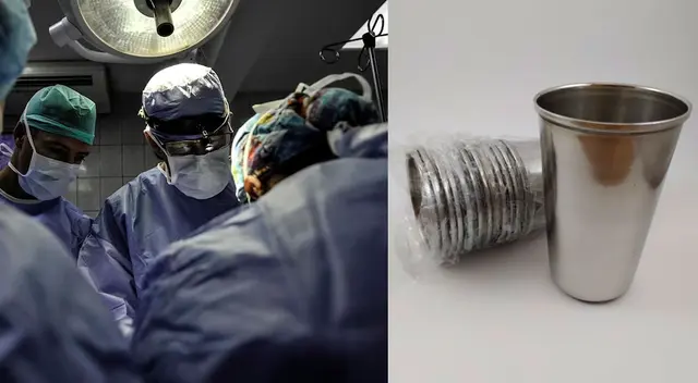 El señor intentó quitarse el vaso por sus propias manos, pero no pudo.