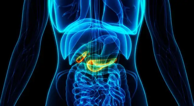 Conoce todo sobre el cáncer de páncreas.