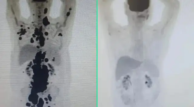 Paulo Peregrino es víctima del cáncer desde el 2018.