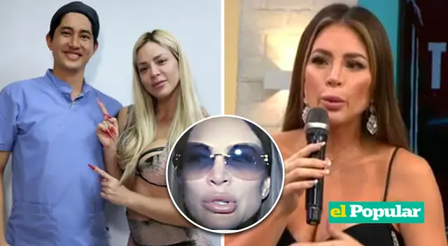 Sheyla Rojas llevó terapias tras perder la movilidad del rostro.