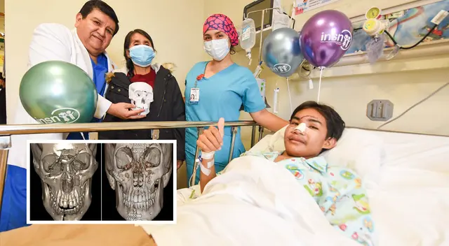 Menor que fue asaltado y le fracturaron 22 veces el rostro